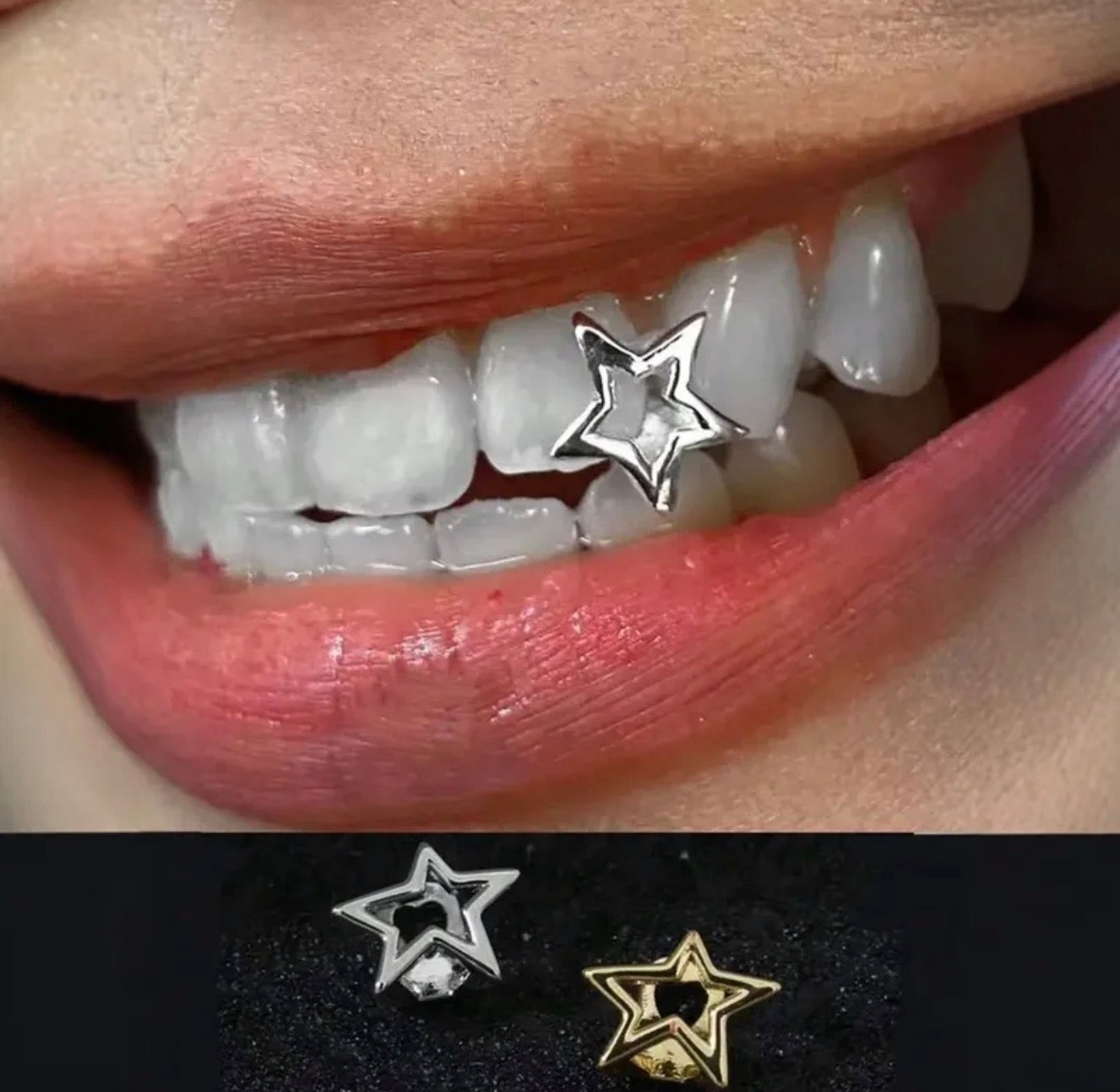 Star grillz
